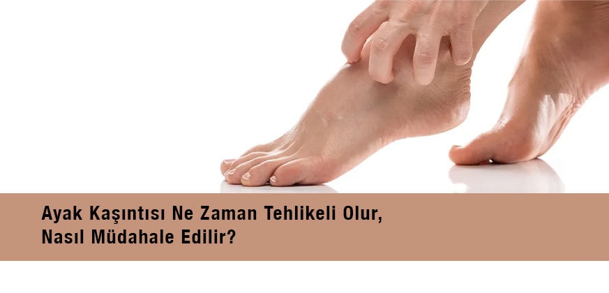 Kaşıntılı Ayaklara Ne Sebep Olur ve Nasıl Tedavi Edilir?	